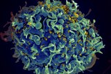 EU regulator approves injectable HIV drug that experts say could help stop transmission
