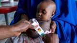 Over 600 malnourished children die in six months in Nigeria: MSF